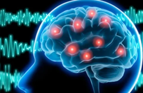 Actualización en Epilepsia